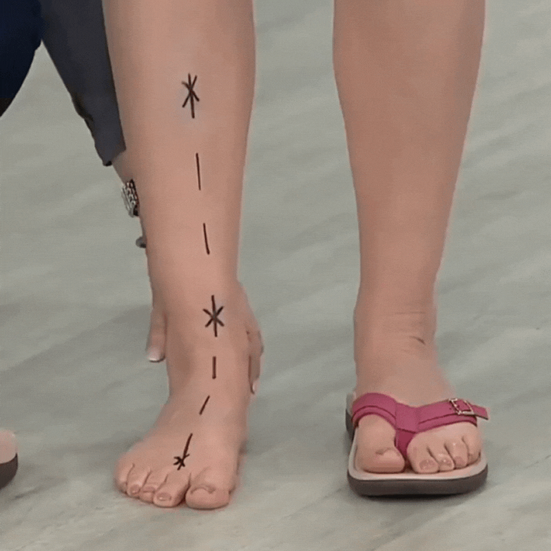 MAUDE - ORTHOPAEDIC SANDALS